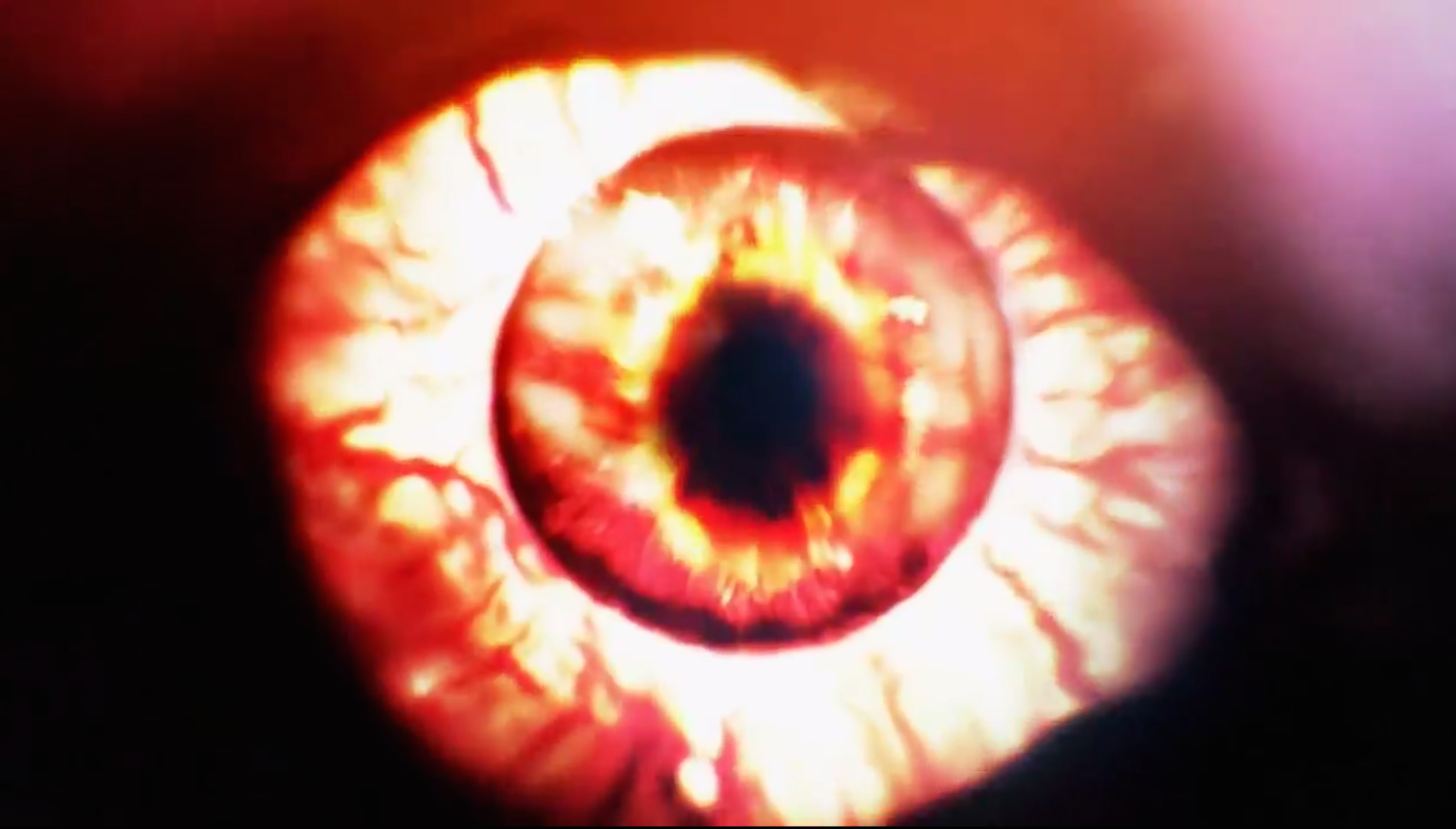 eye